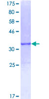 12.5% SDS-PAGE Stained with Coomassie Blue.